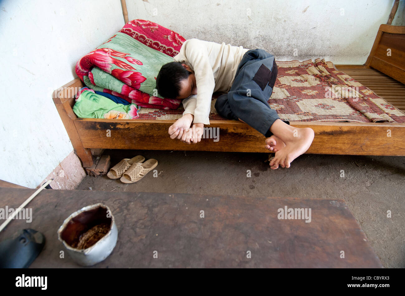 Garçon handicapé de l'adolescent, au Vietnam. Le manque d'oxygène pendant l'accouchement aboutit souvent à de graves handicaps, physique et mentale. Banque D'Images