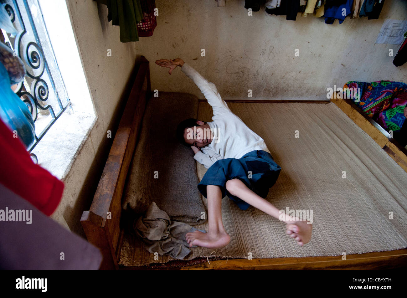 La paralysie cérébrale (CP), patient adolescent, sur un lit dans la chambre du Vietnam. Banque D'Images