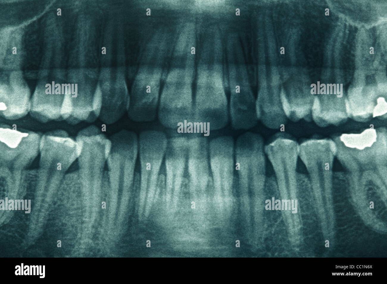 Radiographie dentaire Banque D'Images