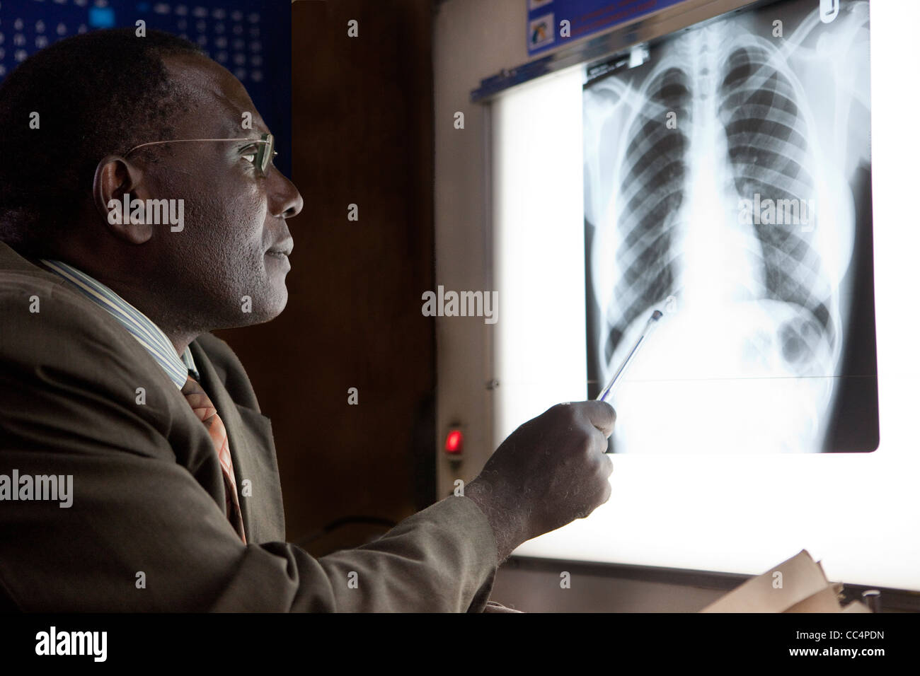 Un médecin à Kampala, Ouganda examine un patient's chest x-ray. Banque D'Images