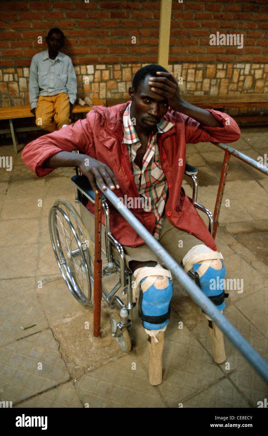 Explosion minière victime avec jambes manquantes l'apprentissage de la marche, Kigali, Rwanda, Afrique du Sud Banque D'Images