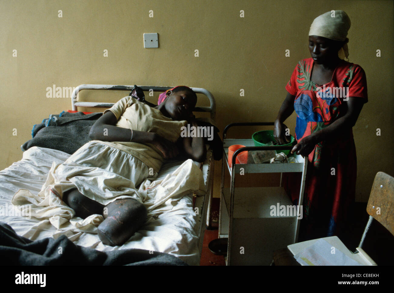 Explosion minière victime avec jambes manquantes, Kigali, Rwanda, Afrique du Sud Banque D'Images