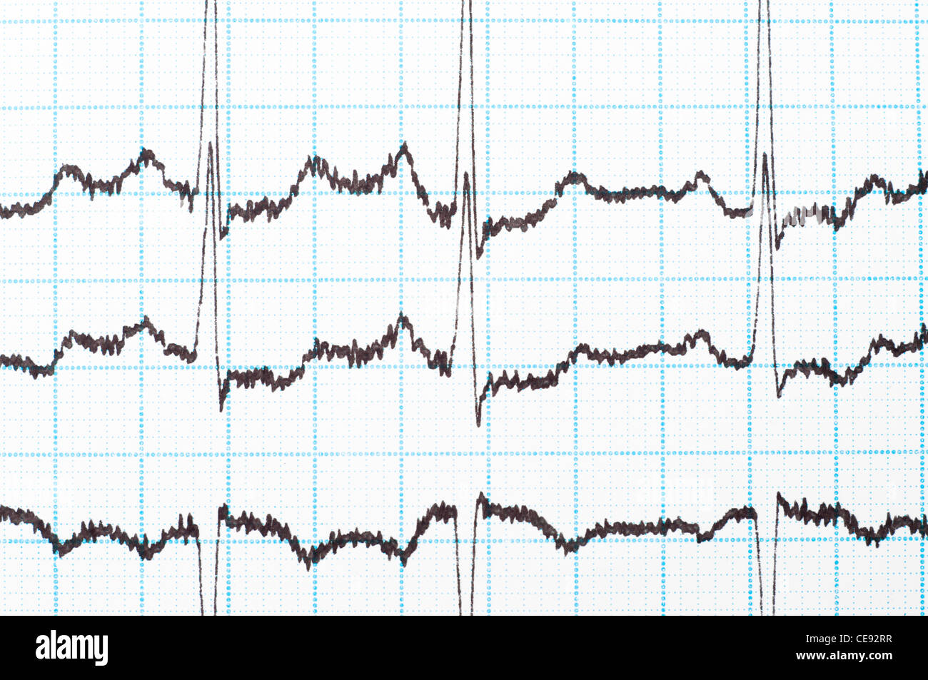 Schéma de l'ekg imprimé sur une feuille de papier Banque D'Images