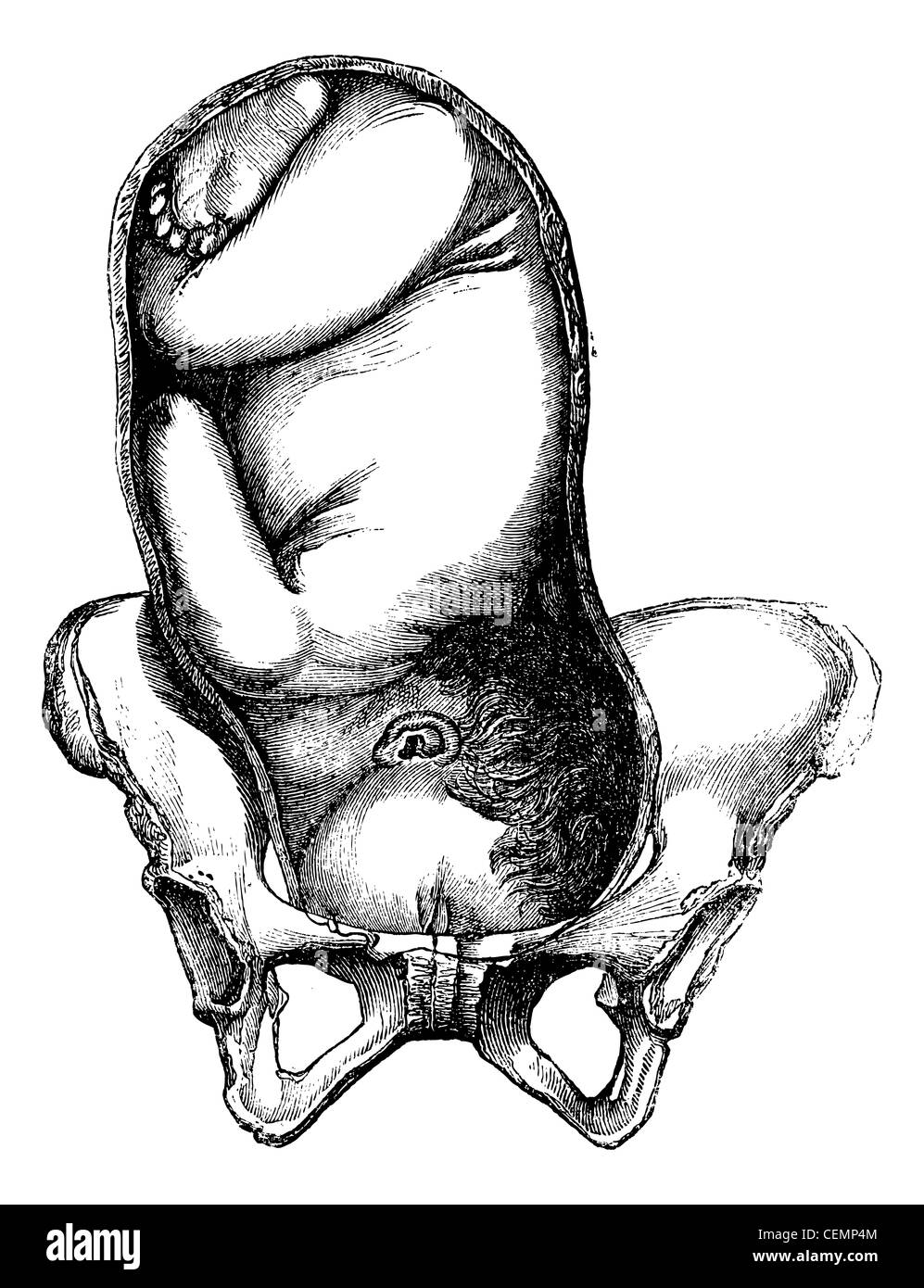 Présentation de la face, du menton vers la droite, vintage engraved illustration. Magasin Pittoresque 1875. Banque D'Images