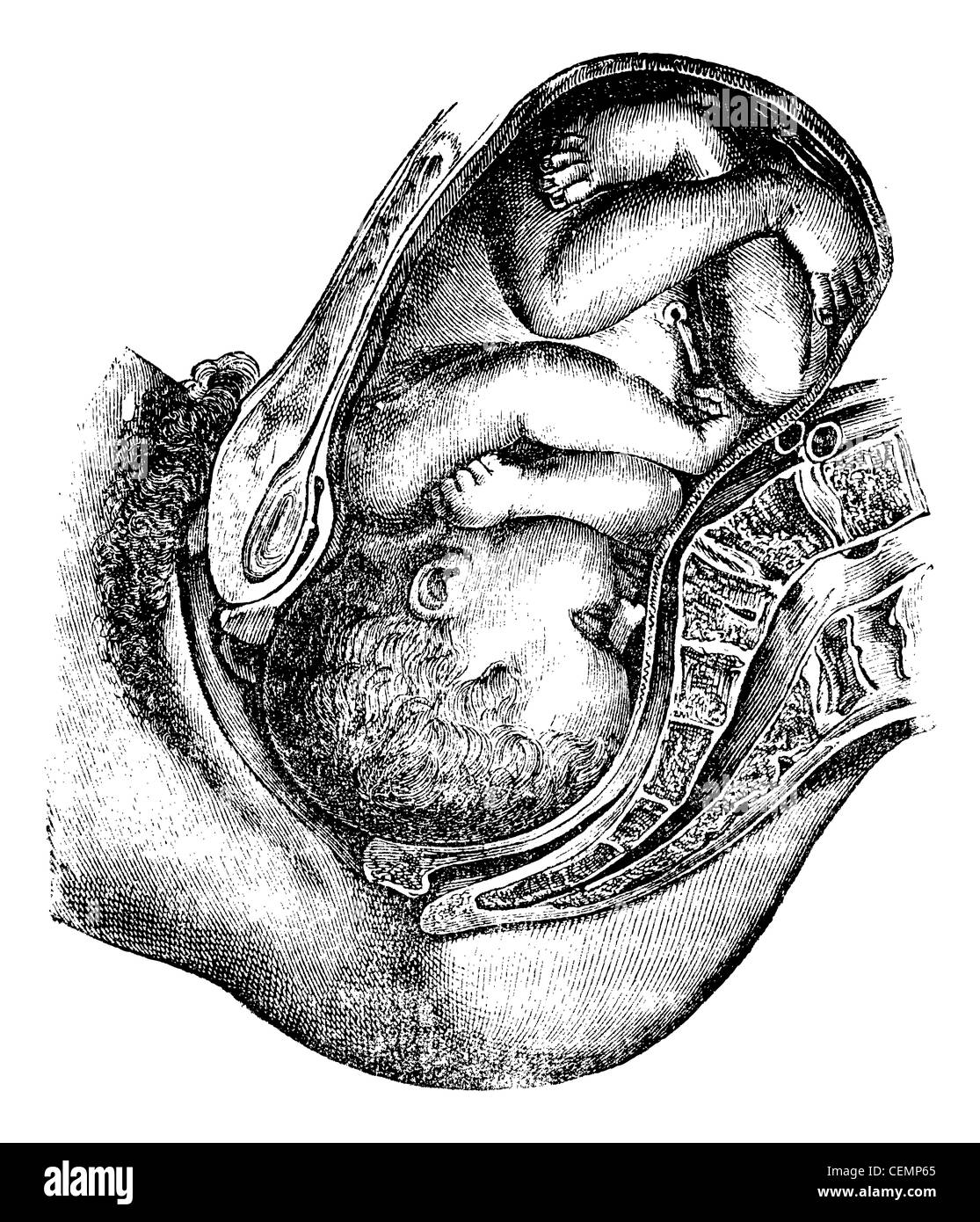 Déjà rempli de rotation, vintage engraved illustration. Magasin Pittoresque 1875. Banque D'Images