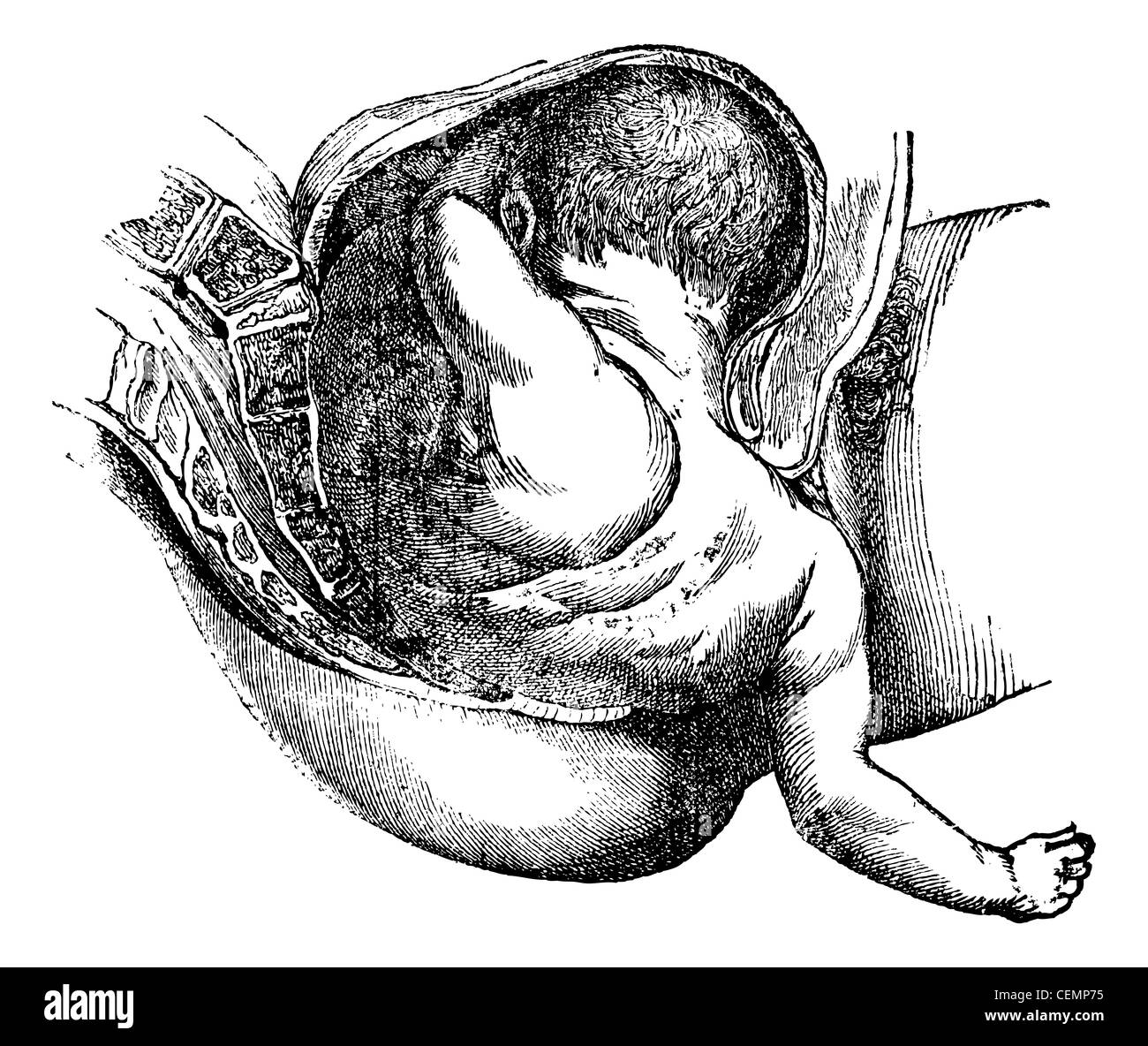Fin de la troisième de l'histoire naturelle, vintage engraved illustration. Magasin Pittoresque 1875. Banque D'Images