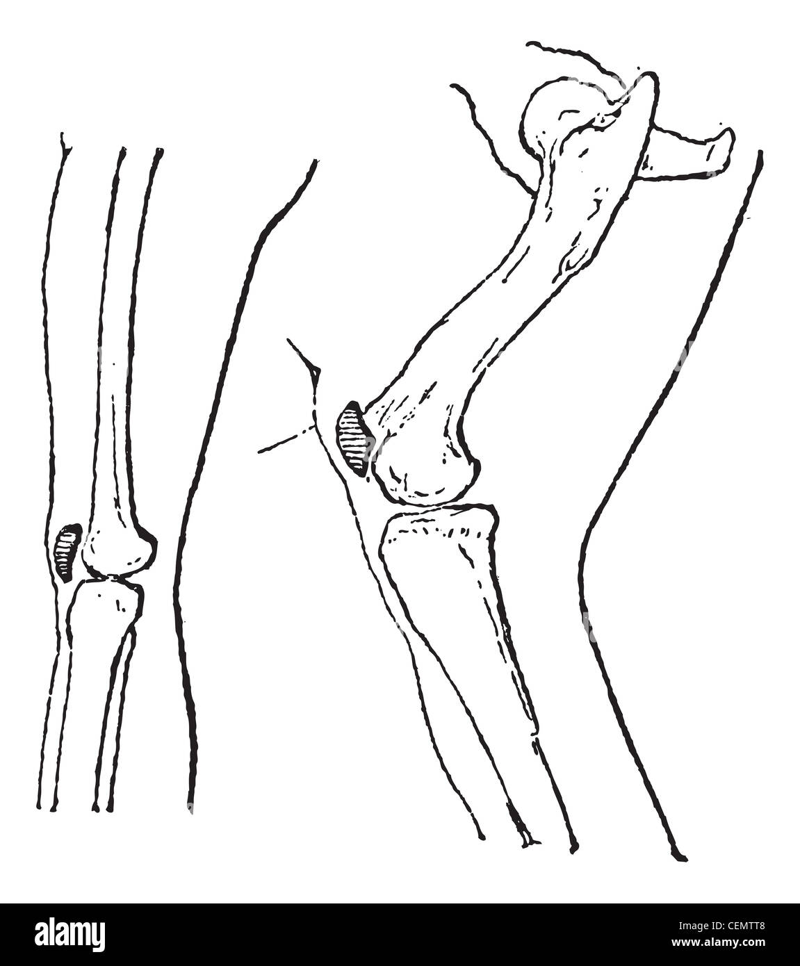 Rotule rotule ou je connais, vintage ou illustration gravée. Dictionnaire des mots et des choses - Larive et Fleury - 1895. Banque D'Images