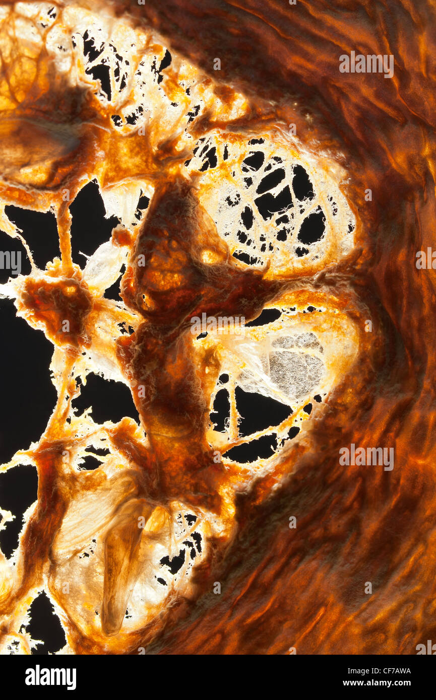 Retour allumé coupe transversale de moelle osseuse avec des graines séchées contre la lumière Banque D'Images