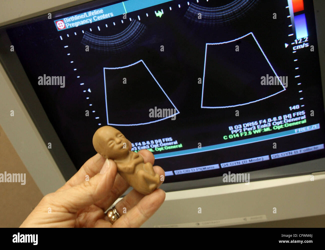 Foetus A 12 Semaines Banque D Image Et Photos Alamy