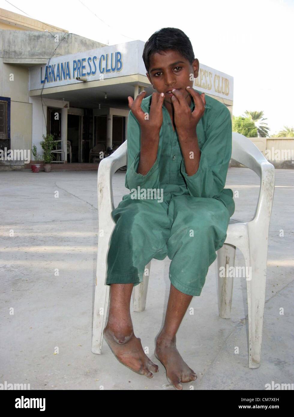 Résident d'Golimar Street, Airport Road, Shakeel Ahmed un handicapé de naissance ayant trois doigts avec pieds de travers est intéressante pour le traitement à Larkana press club le mercredi, Octobre 24, 2012. Banque D'Images