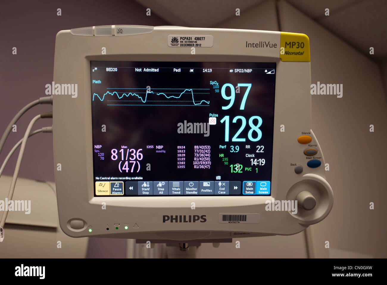 Chambre bébé lit d'hôpital en soins intensifs pour PDA en chirurgie cardiaque de l'équipement médical. De l'électrocardiogramme à l'égard des soins de santé. Banque D'Images