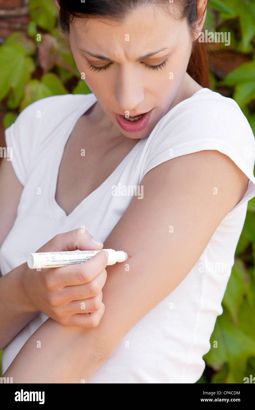 Morsure d'insecte,femme Banque D'Images