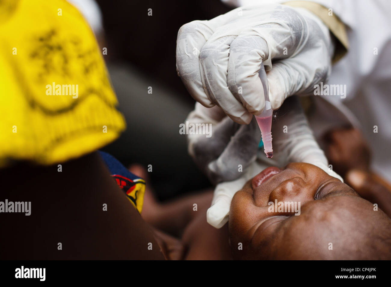 Un enfant a reçu le vaccin contre la polio entre le centre de santé de Nyunzu, dans la ville de Nyunzu, province du Katanga, République démocratique du Congo Banque D'Images