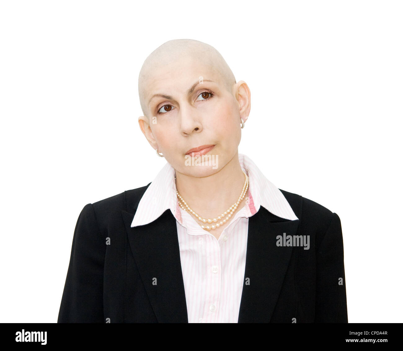 La chimiothérapie - portrait de femme à tête malade du cancer, à côté. Vraie femme, un diagnostic de cancer de l'ovaire et cancer du sein. Banque D'Images