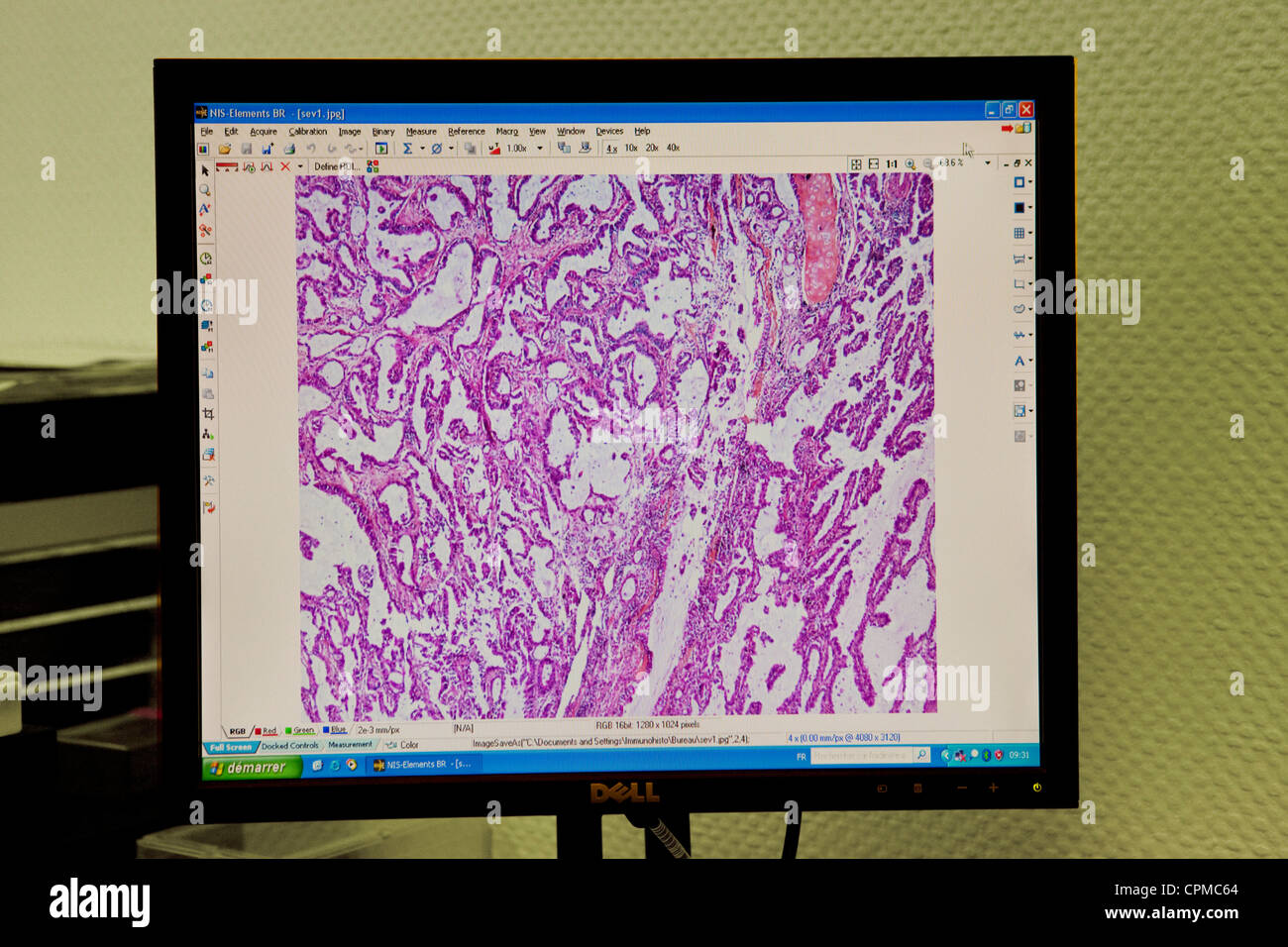POUMON, HISTOLOGIE Banque D'Images