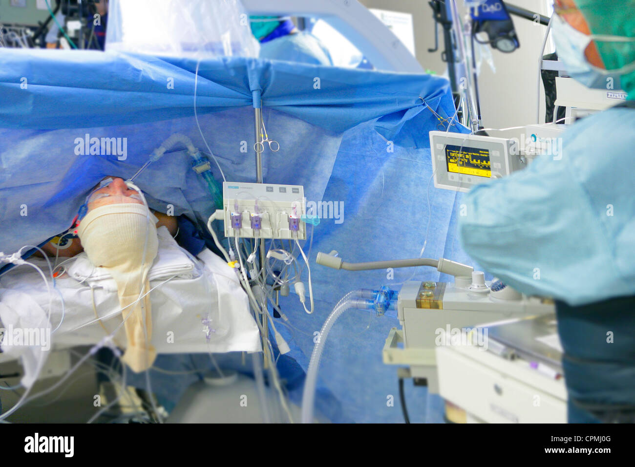 L'ANESTHÉSIE GÉNÉRALE Banque D'Images