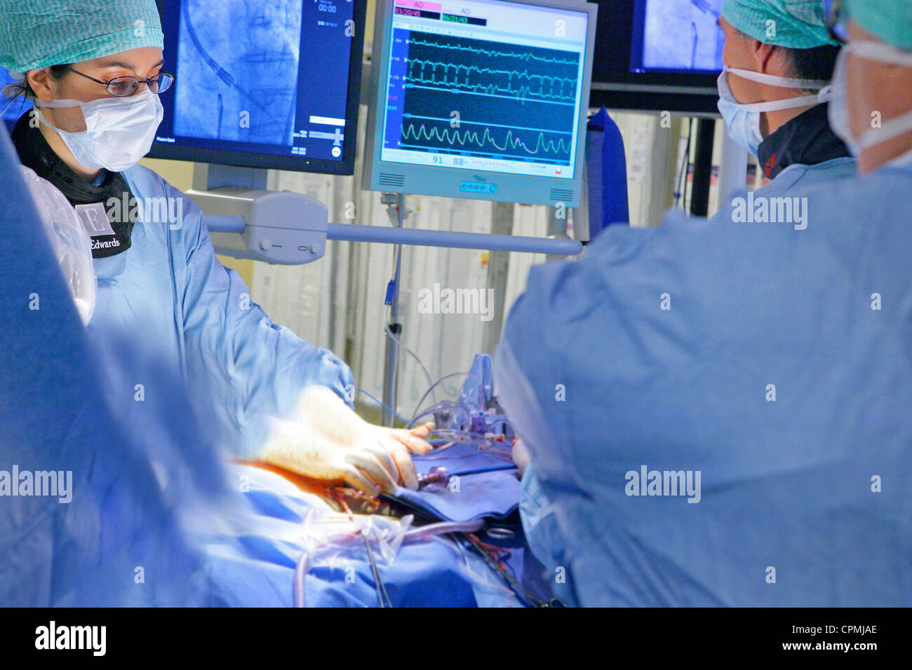 VALVE DE COEUR PROTH. IMPLANTATION Banque D'Images