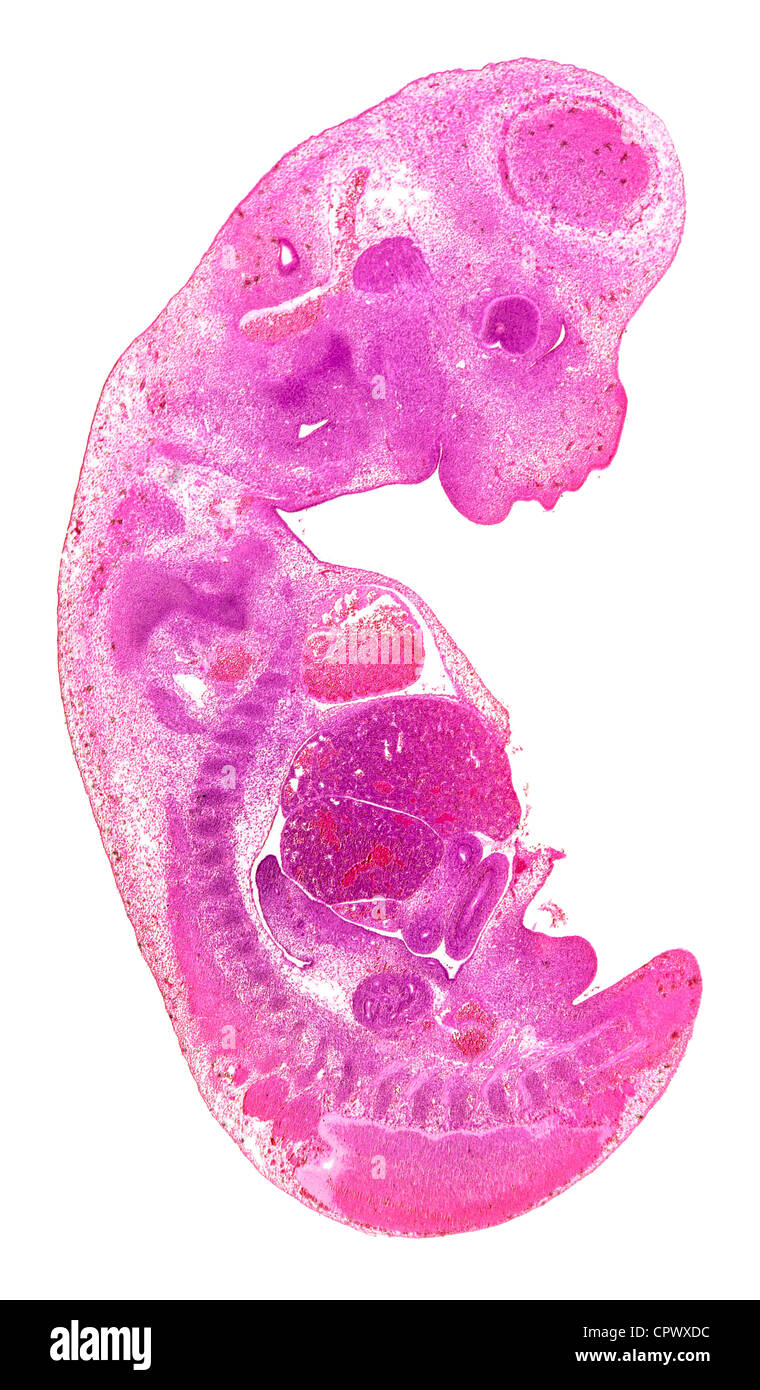 Photomicrographie fond clair taché de signal de la section de glisser un foetus de souris montrant général structure immature Banque D'Images