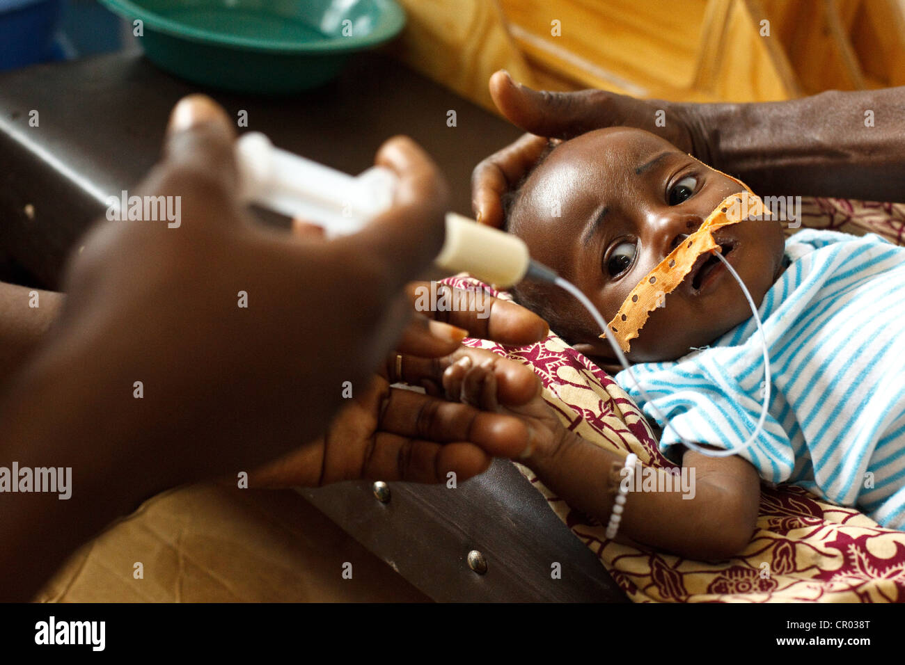 Six mois Kouadio Reine Attawa, qui est sévèrement malnutri, est alimenté par un tube de lait thérapeutique Banque D'Images