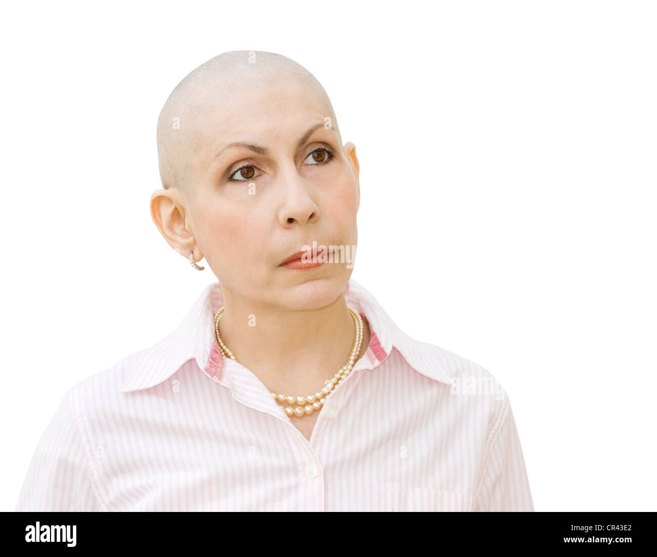 Femme cancer patient subissant une chimiothérapie et la souffrance de la perte de cheveux. Du vrai femme diagnostiquée avec le cancer de l'ovaire et cancer du sein. Banque D'Images
