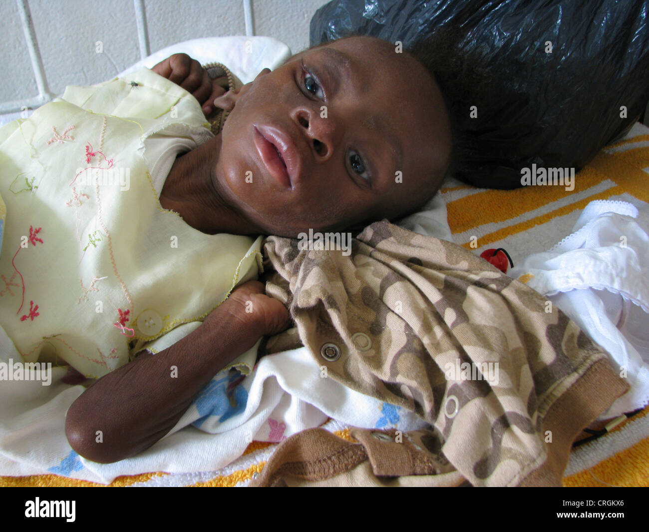 Garçon de 10 mois à l'hôpital, le VIH-positifs et sévèrement malnutri, Haïti, Grande Anse, Jeremie Banque D'Images
