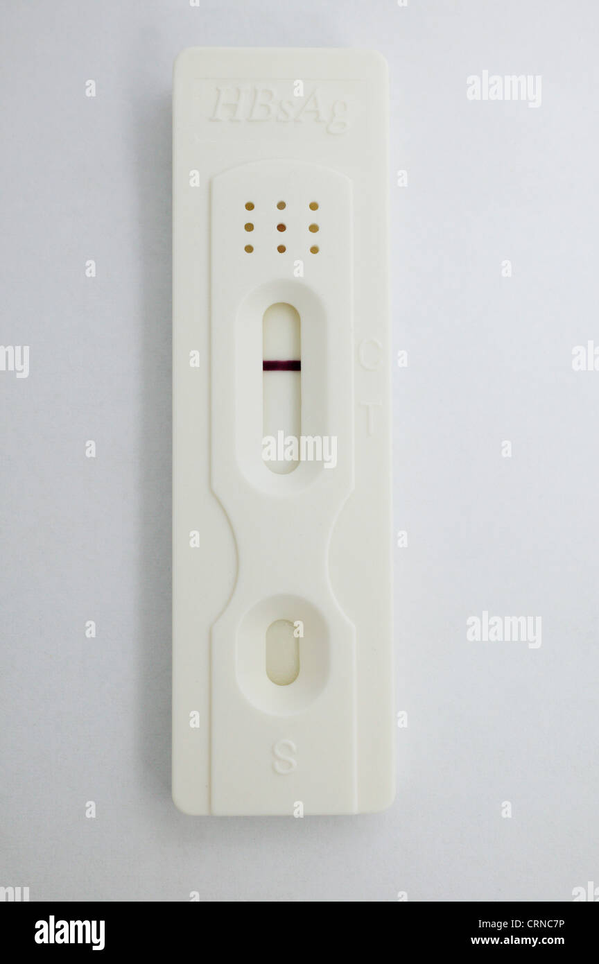 Hématologie Pathologie artérielle Hepititis Test rapide Banque D'Images Hématologie Pathologie artérielle Hepititis Test rapide Banque D'Images