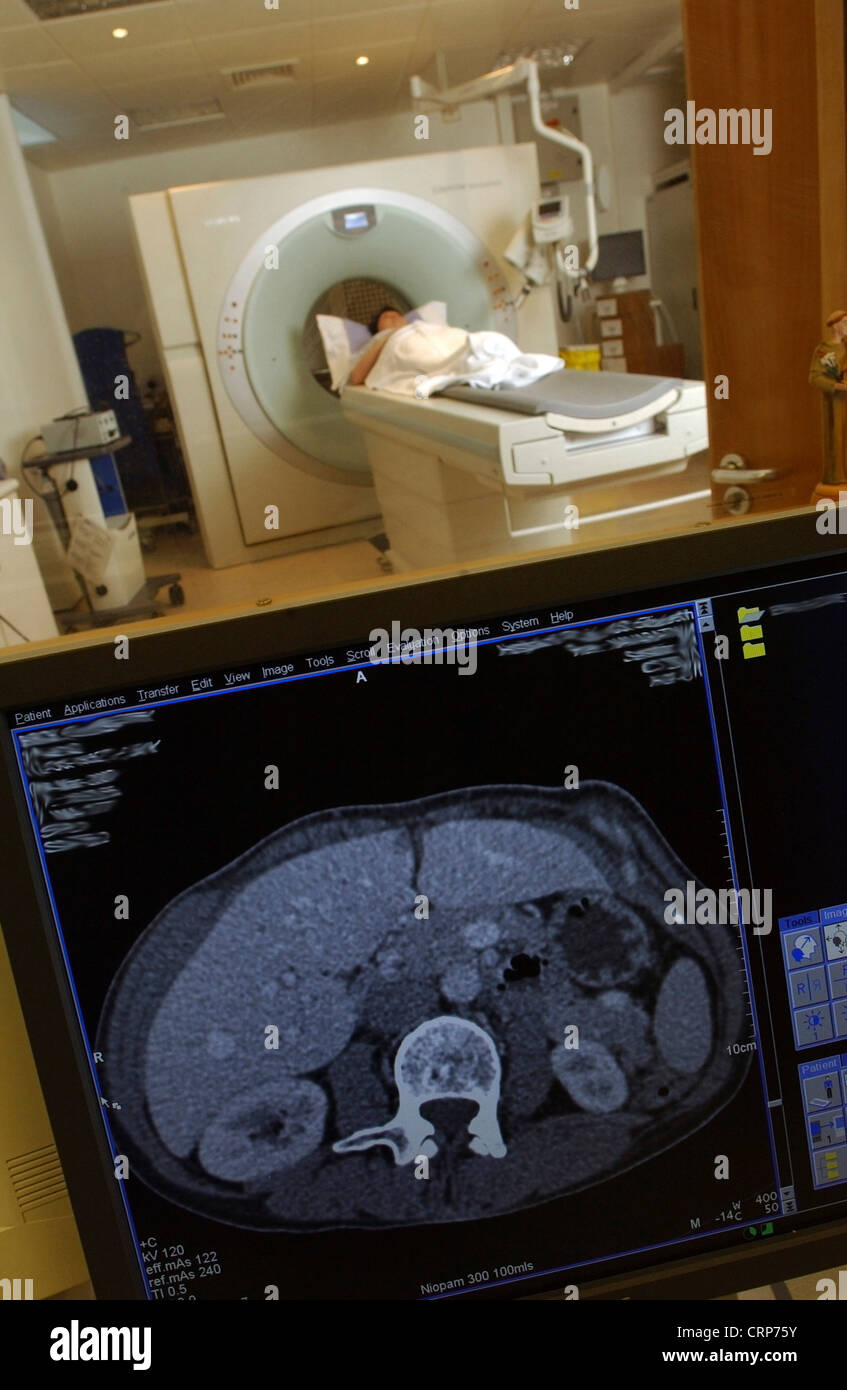 Un patient ayant un scanner CT avec l'image présentée sur un écran d'ordinateur Banque D'Images