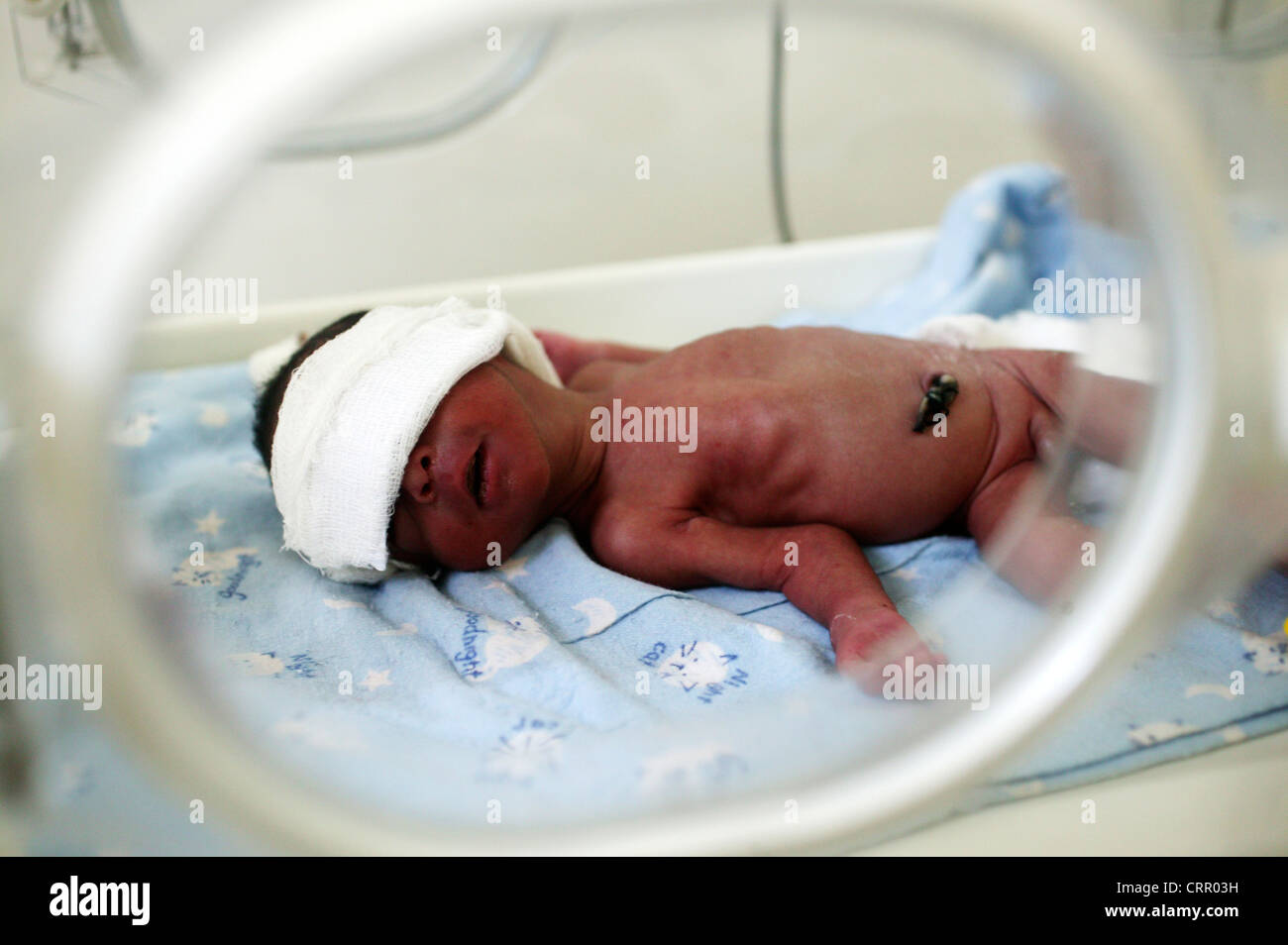 Un bébé de 3 jours né prématuré - (spontanément par voie vaginale), né à 32  semaines d'un poids 1,45kg Photo Stock - Alamy