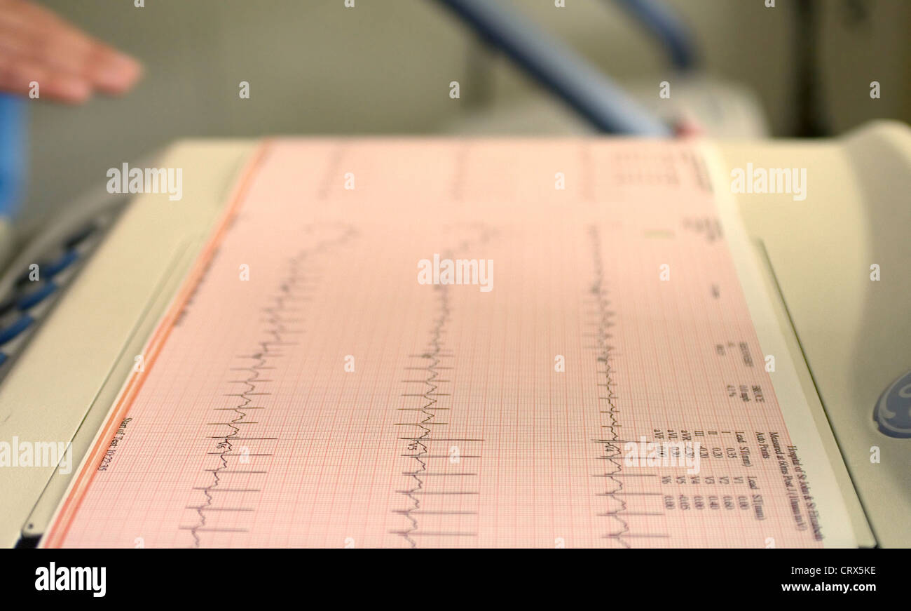 L'enregistrement d'un électrocardiogramme chez les patients un cycle cardiaque produit par un électrocardiographe Banque D'Images