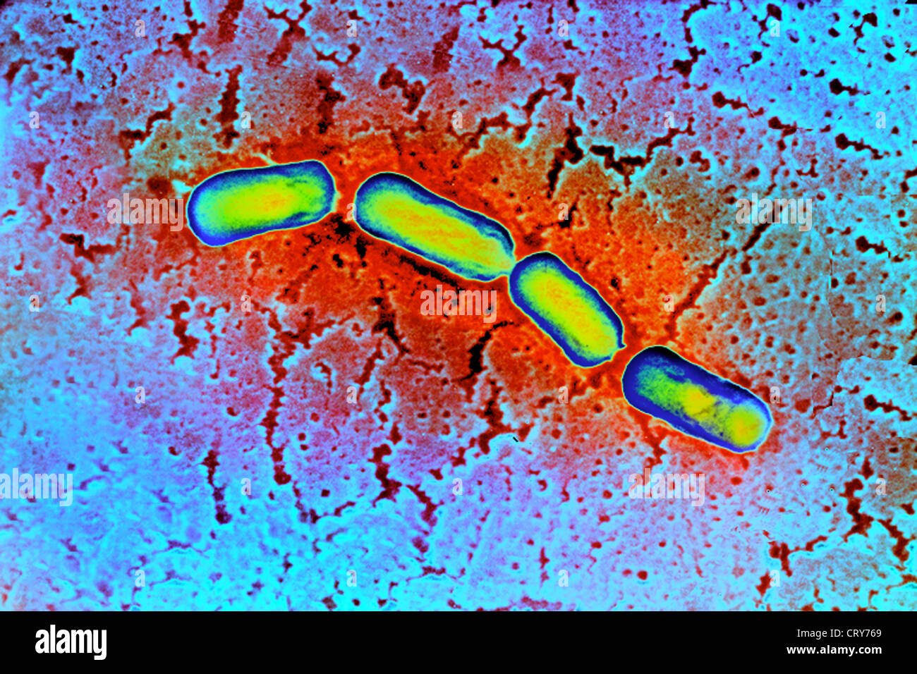 CLOSTRIDIUM BOTULINUM Banque D'Images