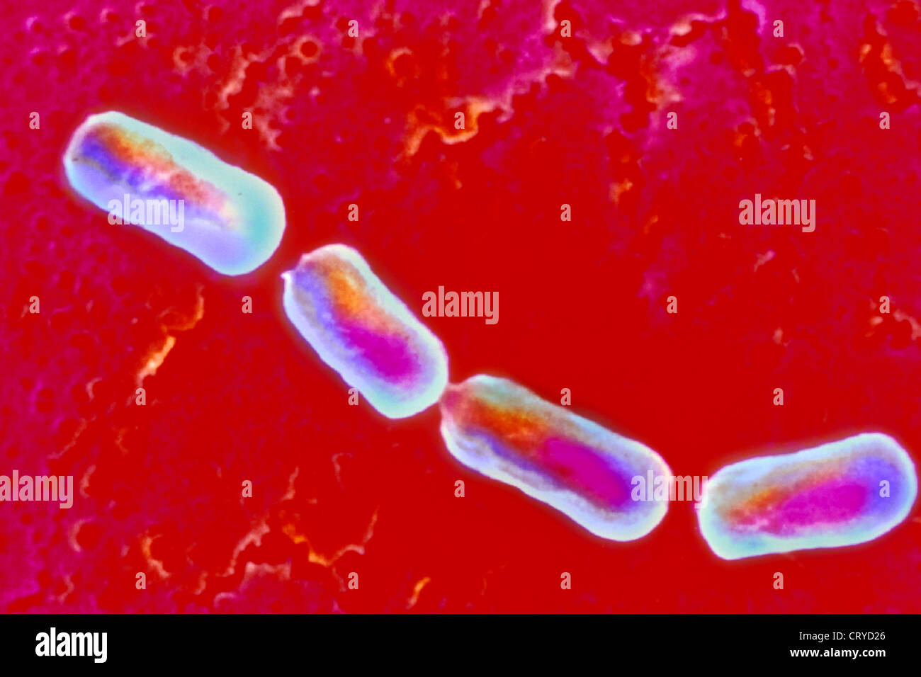 CLOSTRIDIUM BOTULINUM Banque D'Images