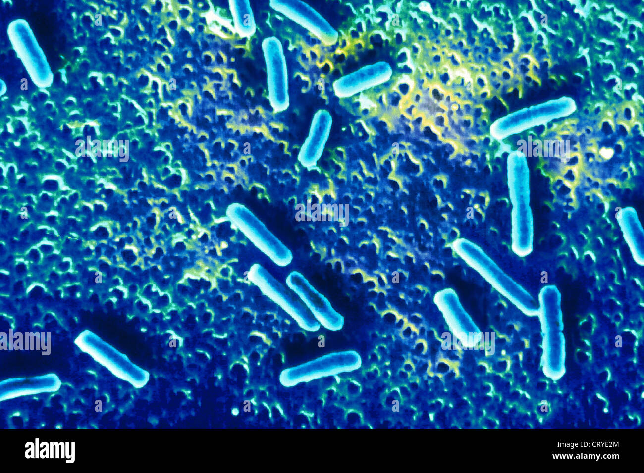 Yersinia sp Banque de photographies et d’images à haute résolution - Alamy