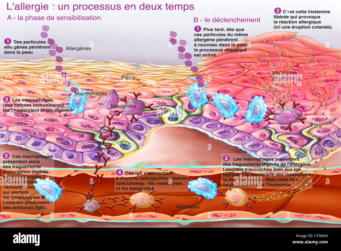 Allergie, dessin Banque D'Images