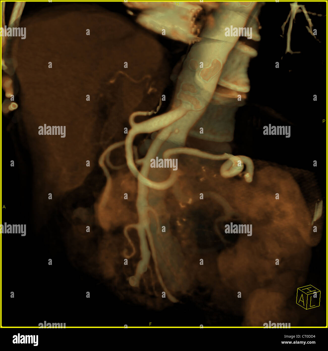 ABDOMEN, SCAN Banque D'Images