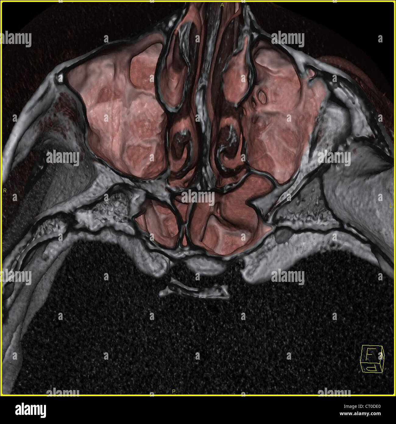 SINUS, SCAN Banque D'Images