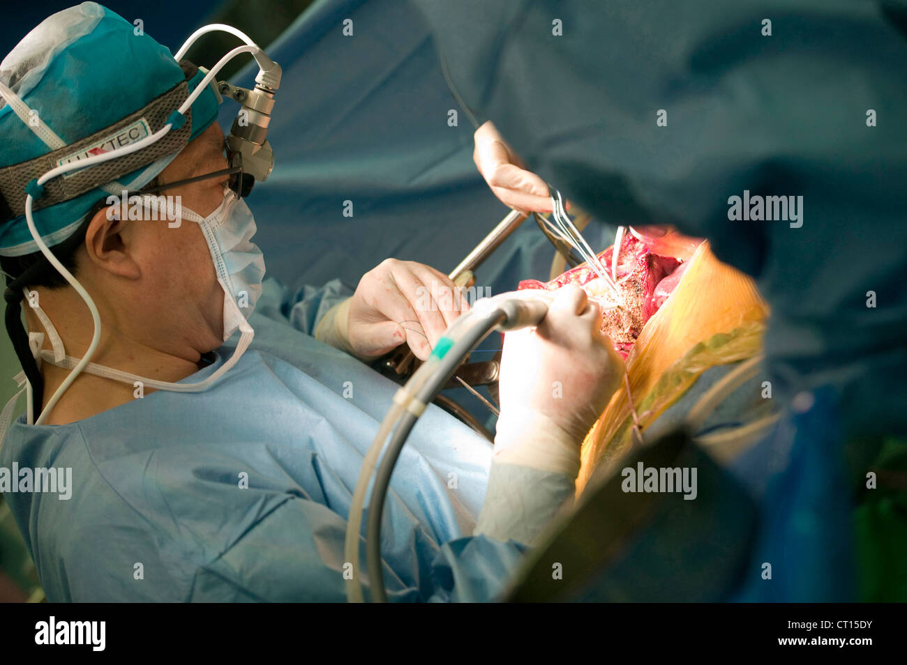 Chirurgiens d'effectuer une greffe du foie au Samsung Medical Center, la Corée du Sud. Banque D'Images