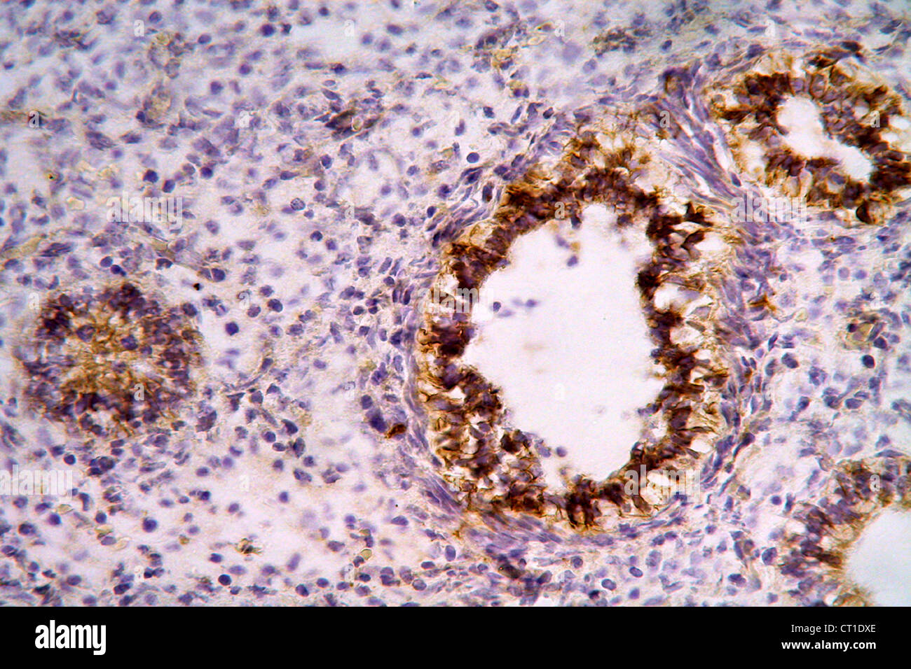 FTAL histologie pulmonaire Banque D'Images