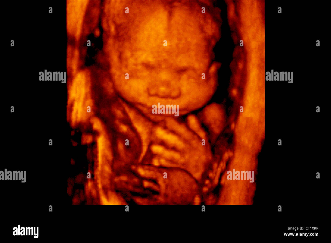 Fœtus L Echographie 3d Photo Stock Alamy