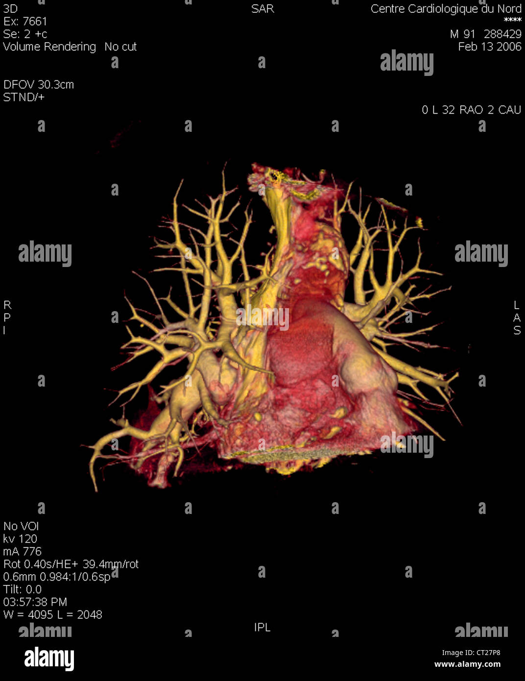 Vascularisation pulmonaire Banque de photographies et d’images à haute — free download