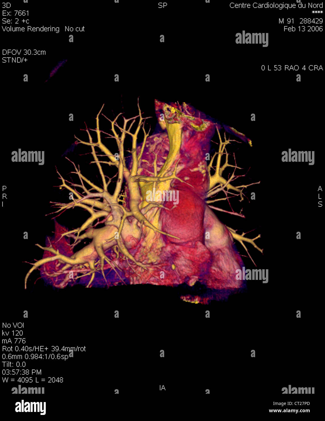 Vascularisation pulmonaire Banque de photographies et d’images à haute — free download