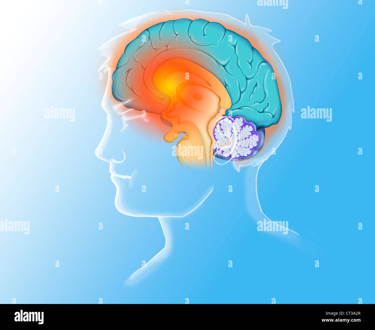 Maux de tête, artwork Banque D'Images