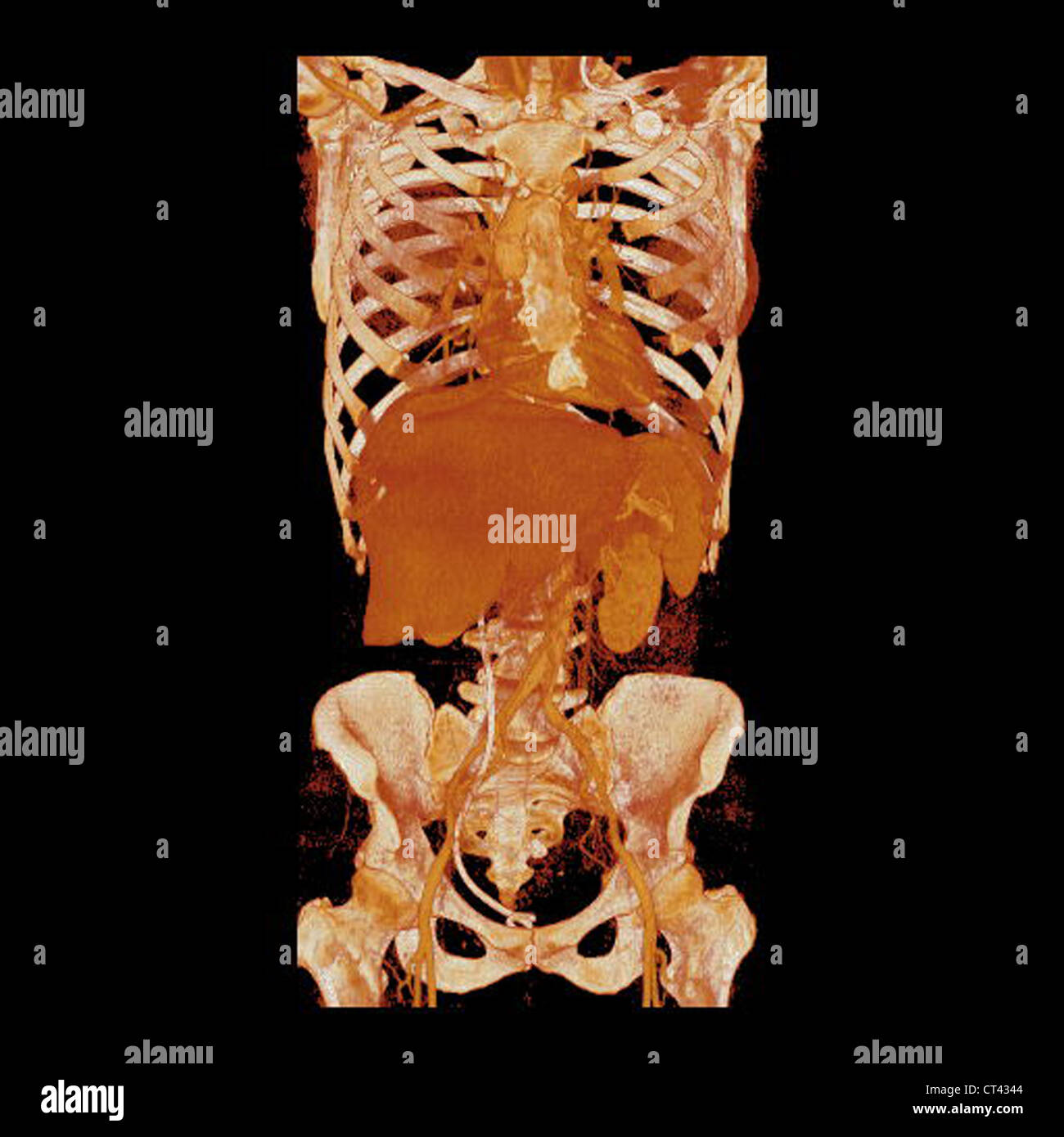 TRONC, 3D SCAN Banque D'Images