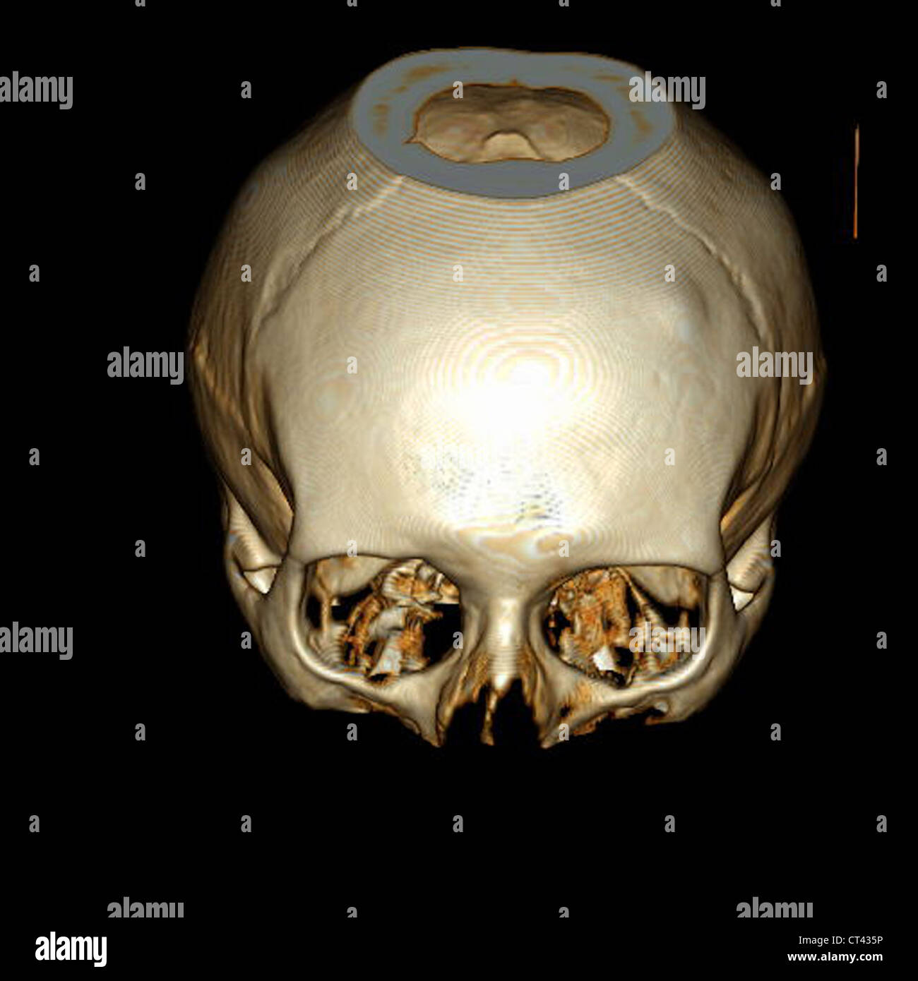 CRÂNE, 3D SCAN Banque D'Images