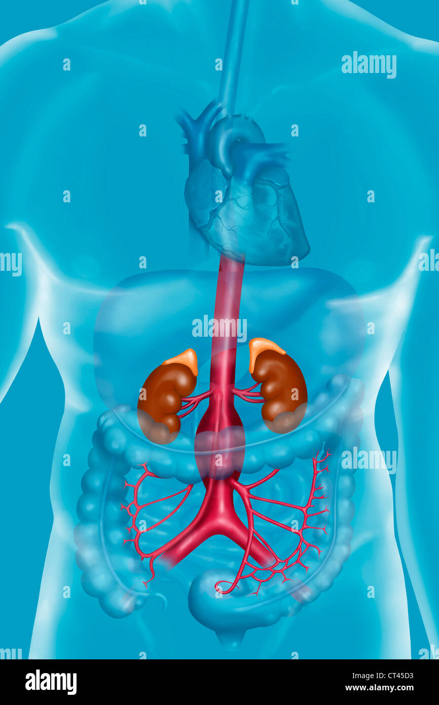 Anévrysme DE L'aorte abdominale Banque D'Images