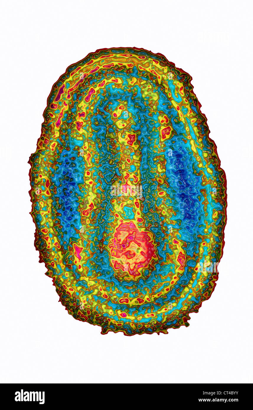 VIRUS DE LA SHARKA Banque D'Images