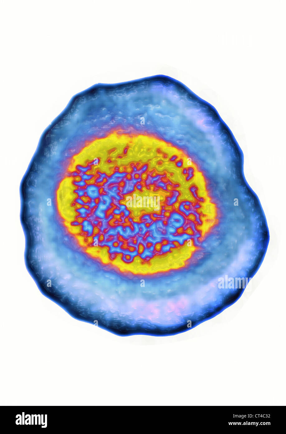 L'HERPÈS SIMPLEX VIRUS Banque D'Images