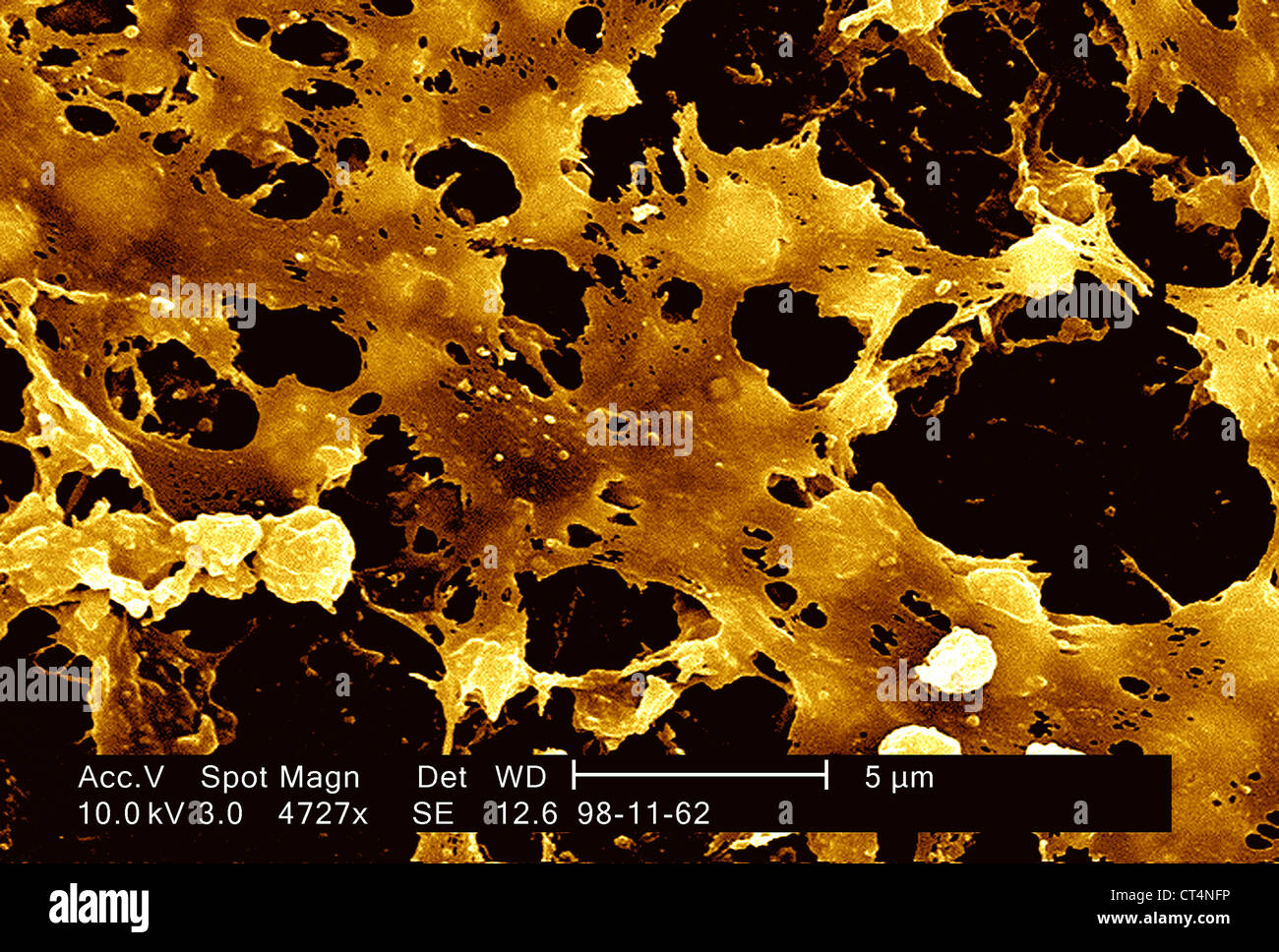 Staphylocoque doré Banque de photographies et d’images à haute ...