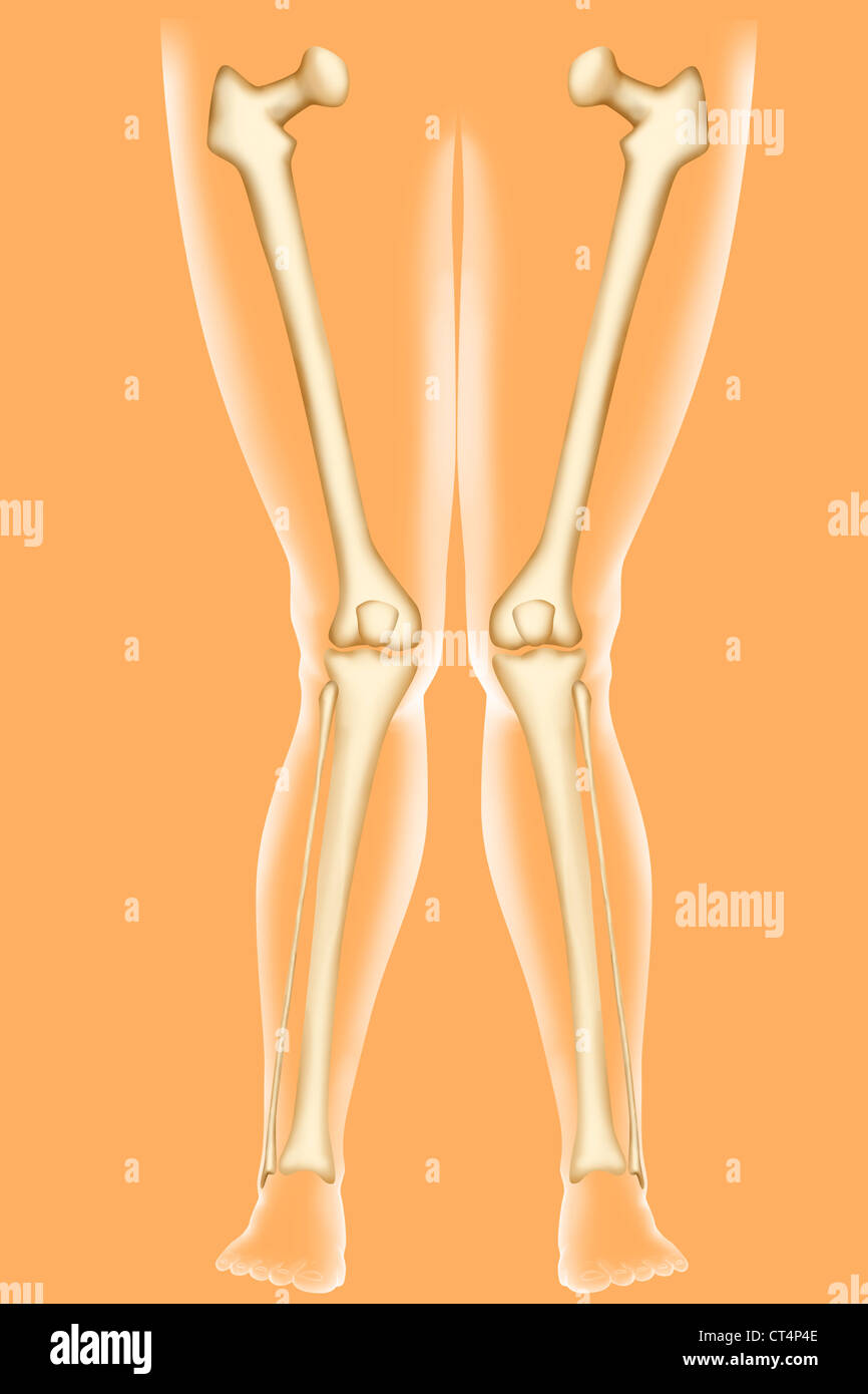 GENU VALGUM, ILLUSTRATION Banque D'Images