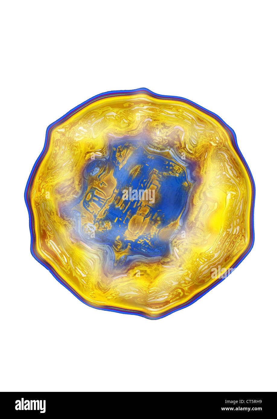 L'HÉPATITE E Banque D'Images