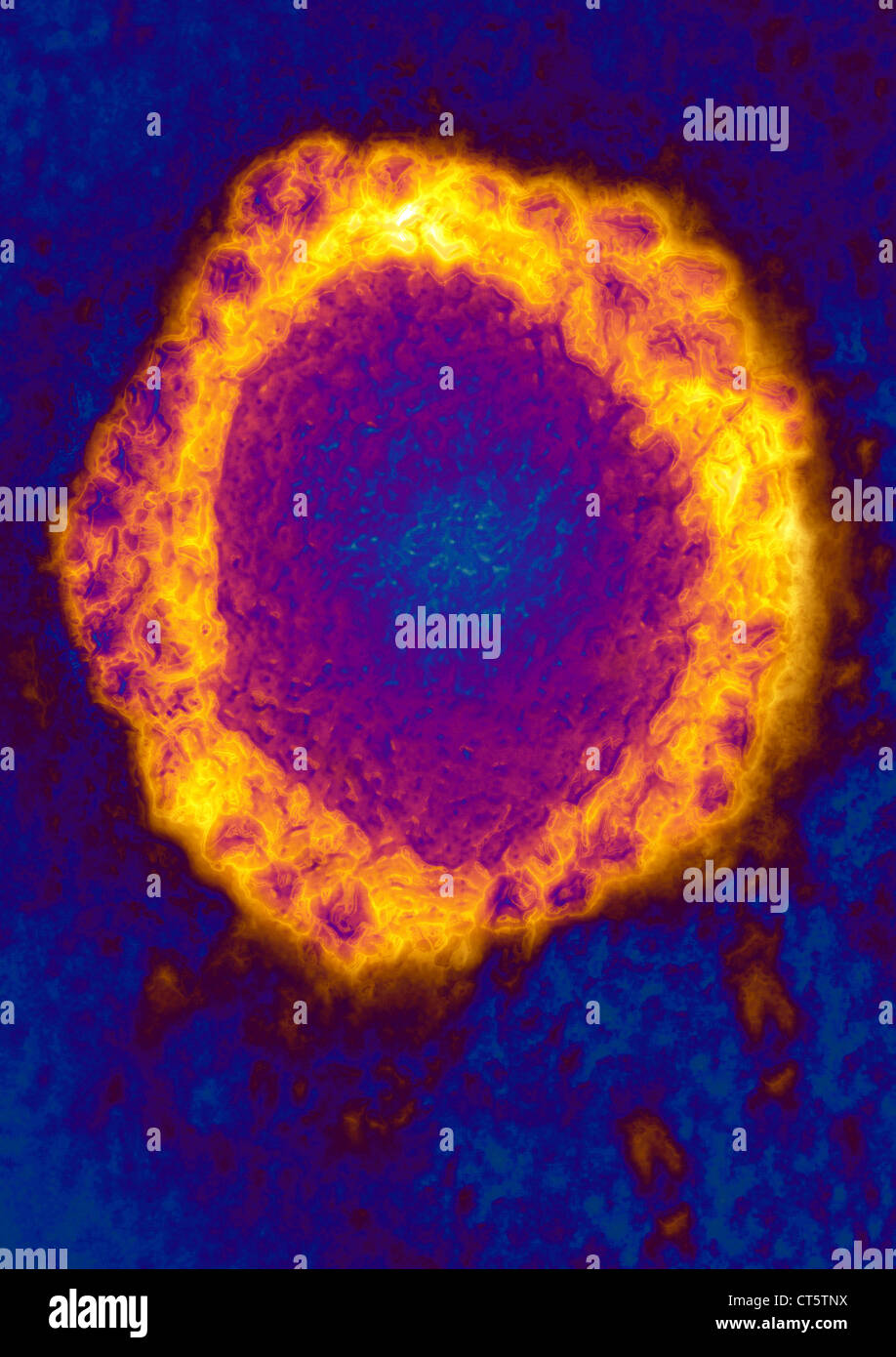 CORONAVIRUS, le TEM Banque D'Images